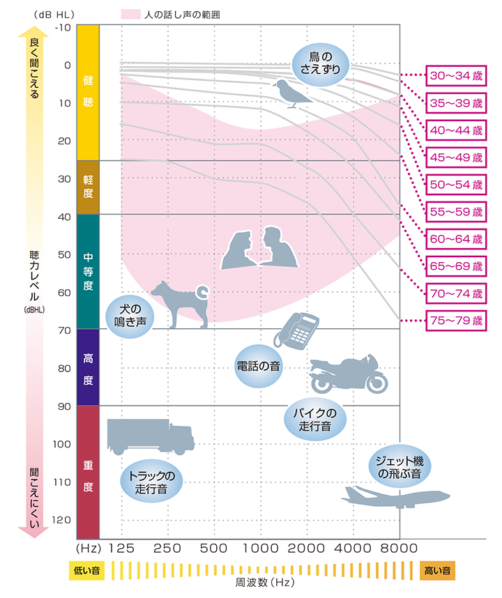 聴力レベル