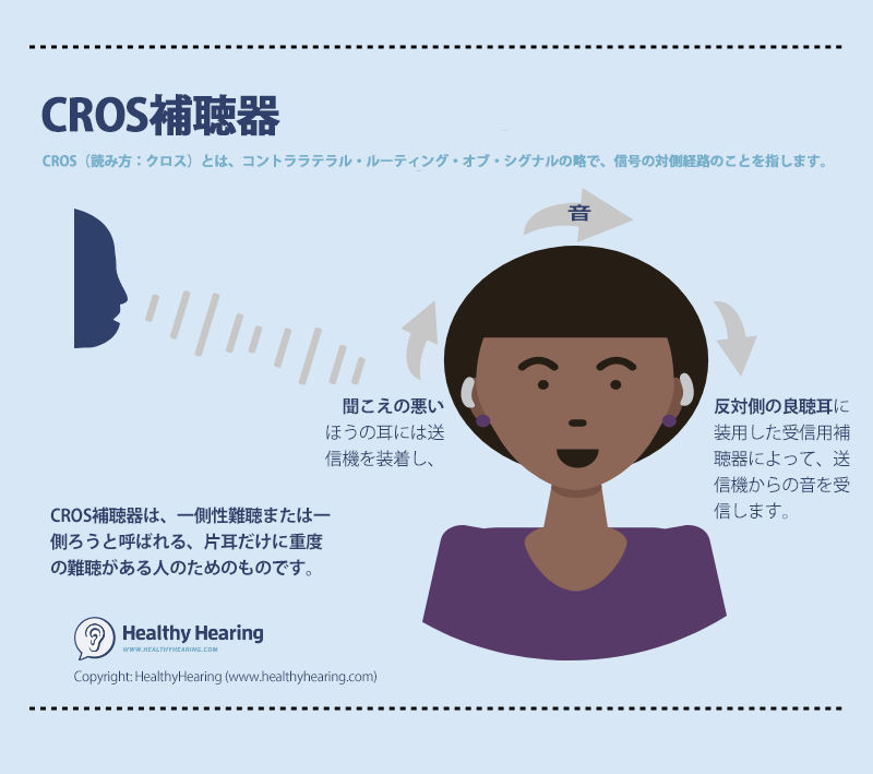 CROS補聴器